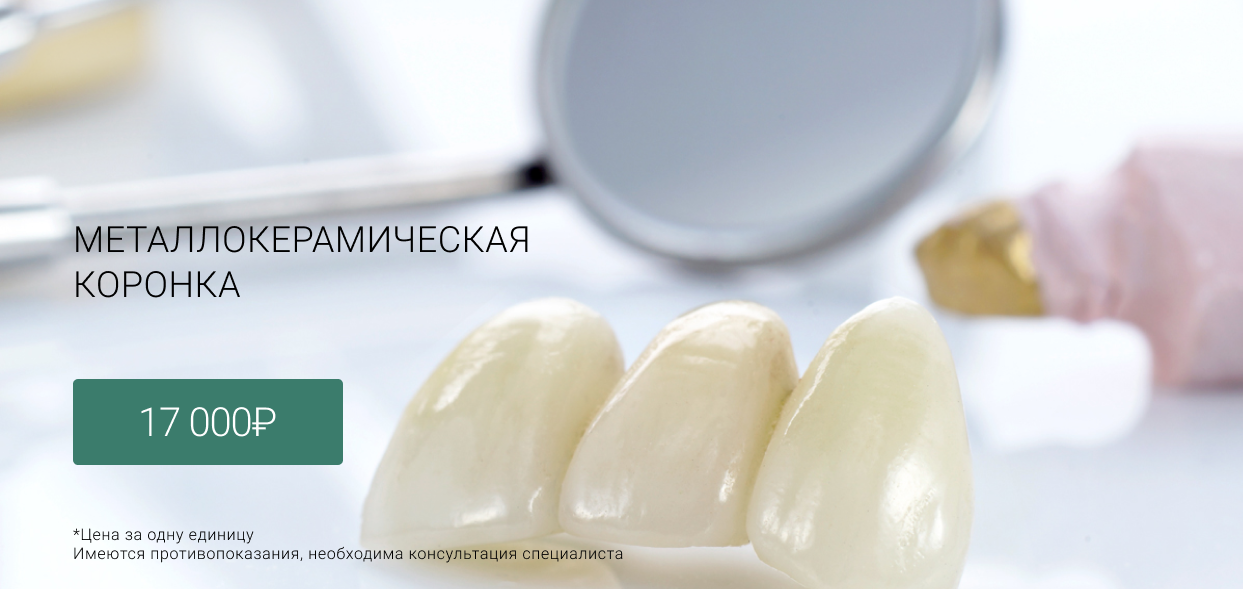 Металлокерамическая коронка Лиговский проспект 228, Маршала Казакова 72