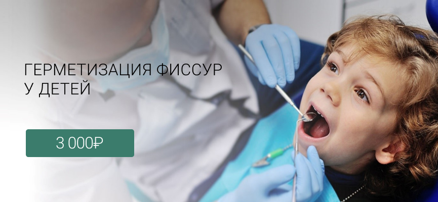Герметизация фиссур у детей Лиговский проспект 228, Маршала Казакова 72