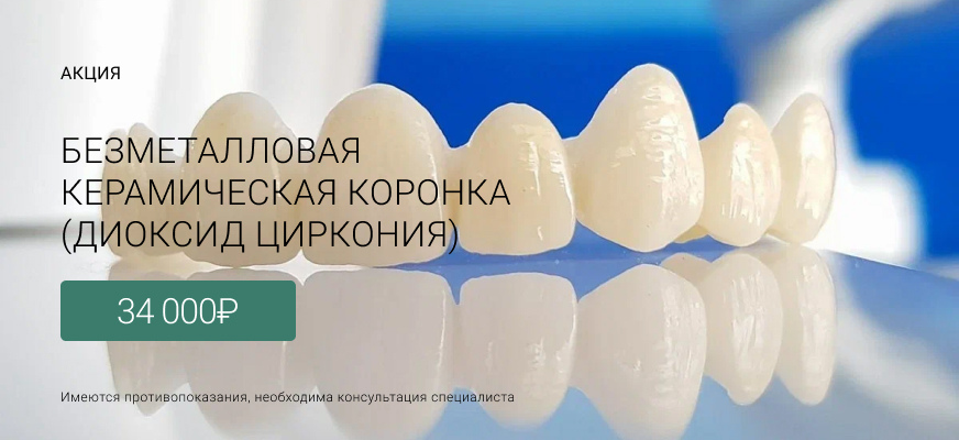 Коронки из диоксид циркония Лиговский проспект 228, Маршала Казакова 72